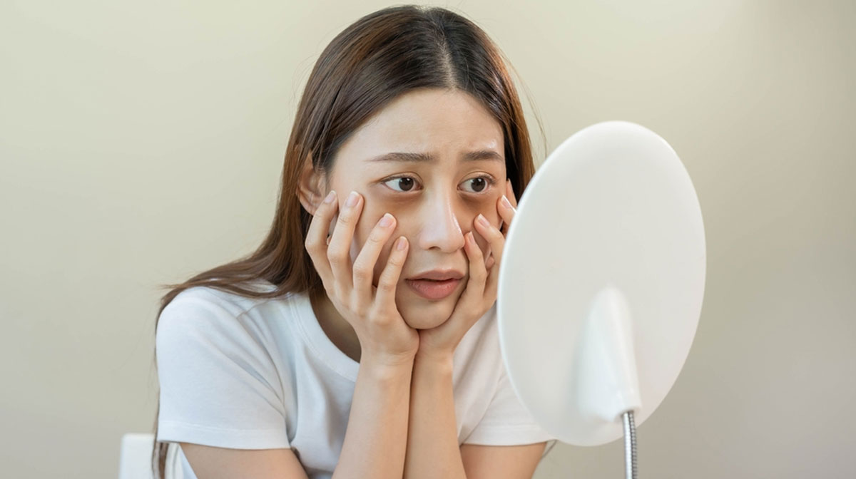 Dark Circles Removal Treatment In Mumbai at Mumbai Cosmetic Centre